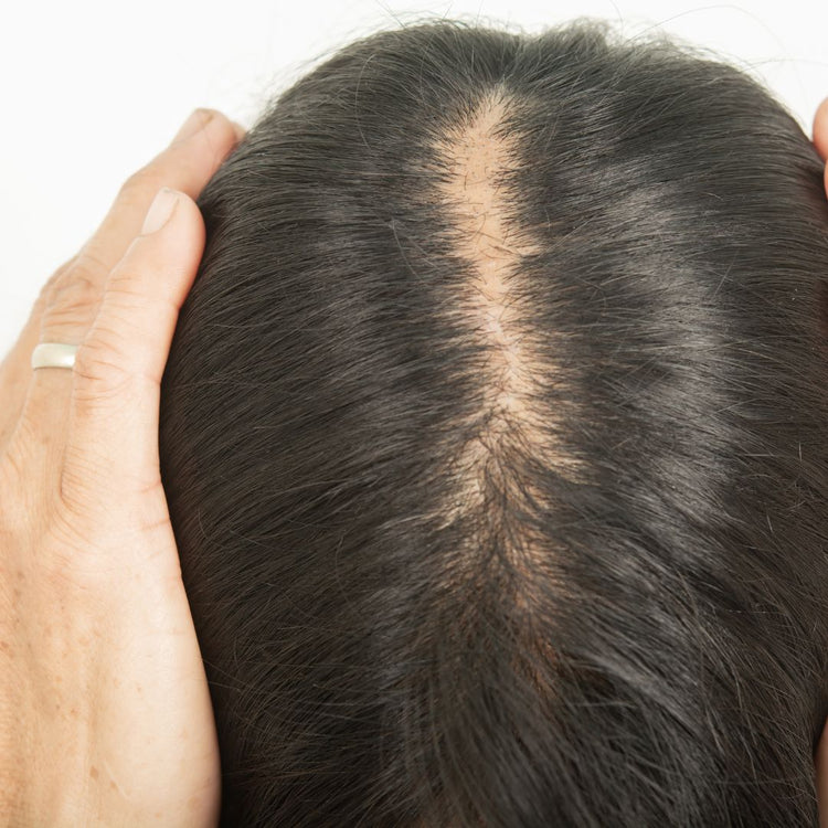 Dun Haar